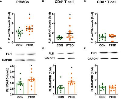 FLI1 in PBMCs contributes to elevated inflammation in combat-related posttraumatic stress disorder